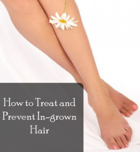 How to treat and prevent ingrown hair (1)