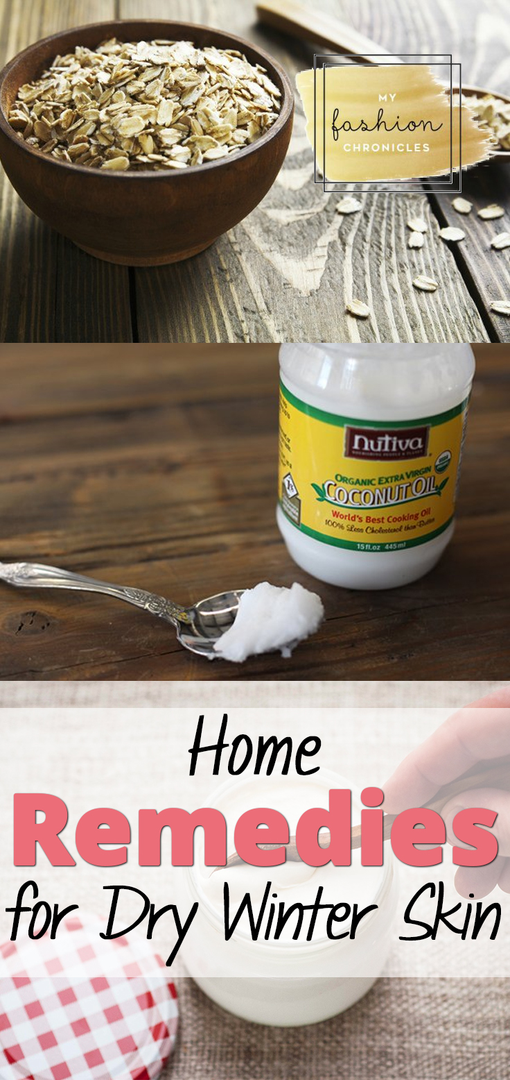 Home Remedies for Dry Winter Skin • Page 14 of 14